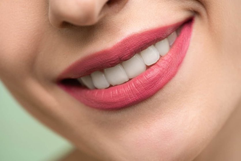 Cómo mantener los dientes limpios y sanos ¡presume de sonrisa! Foto: Pexels