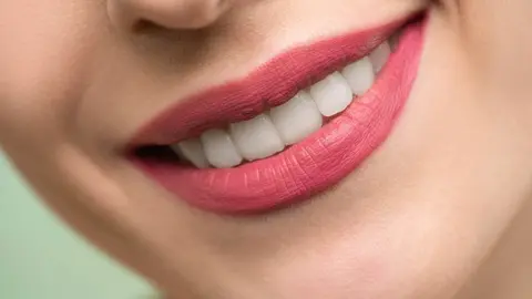 Cómo mantener los dientes limpios y sanos ¡presume de sonrisa! Foto: Pexels