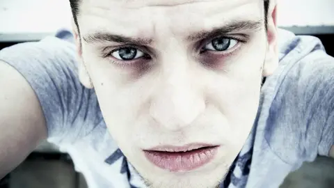 ¿Cómo reducir el color oscuro de las ojeras? Foto: pixabay.