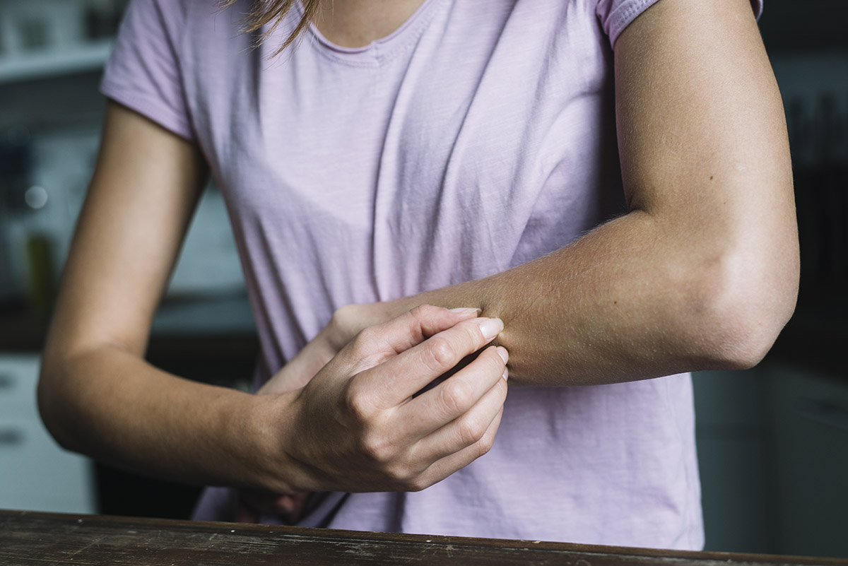 Qué es y qué hacer contra la alergia al sol