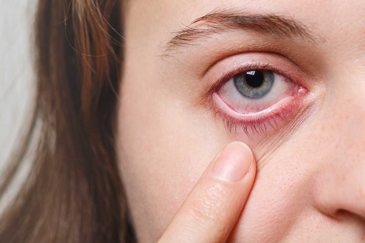 Alergia al maquillaje