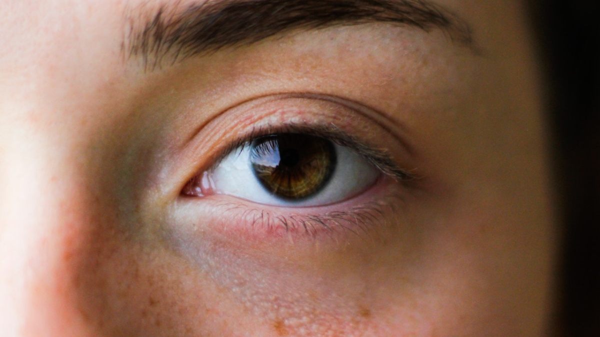 Las ojeras pueden tratarse con remedios caseros y médicos. Foto: pexels.
